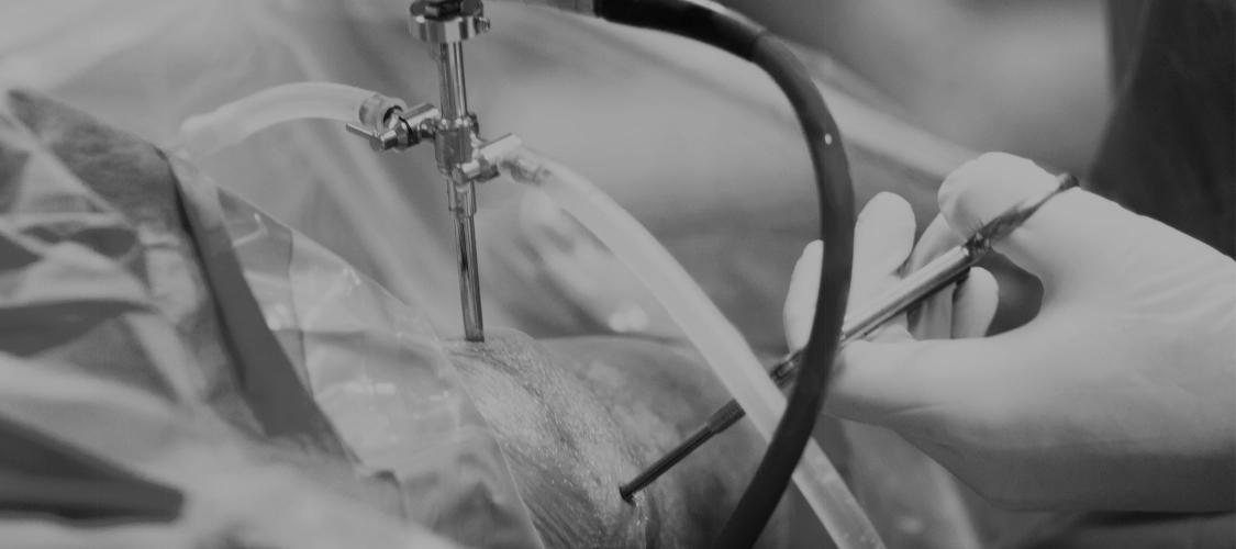 Surgeon performing an arthroscopic knee surgery